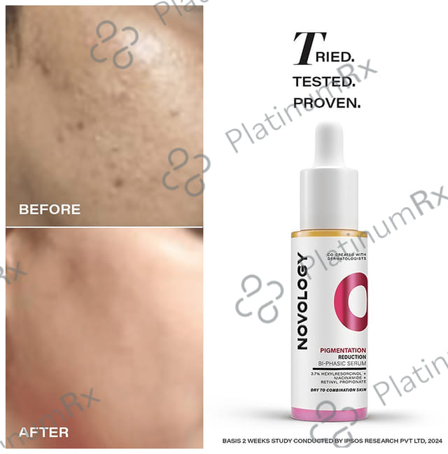 Novology 3.7% Niacinamide + Hexyl Resorcinol + Retinyl Propionate Bi-Phasic Hyperpigmentation Serum