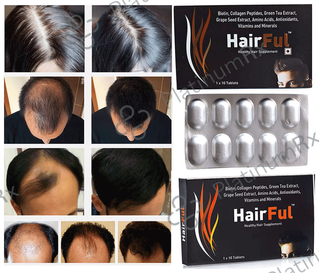 HairFul Tablet for Women & Men Hair Care