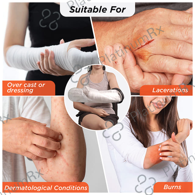 Vissco Core Cast Cover - Arm Upto Wrist to Elbow Universal Grey
