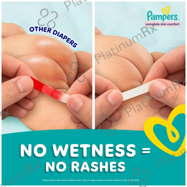 Pampers All-Round Protection Anti Rash Blanket Diaper Lotion with Aloe Vera XL