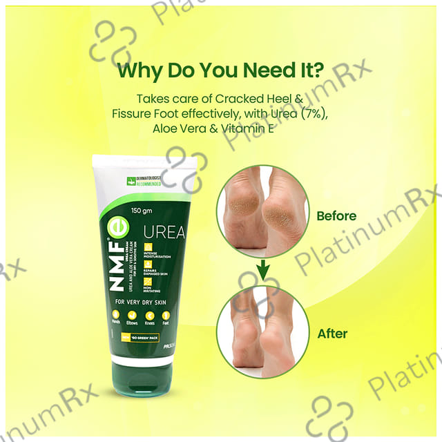Nmf E Urea Cream 150gm