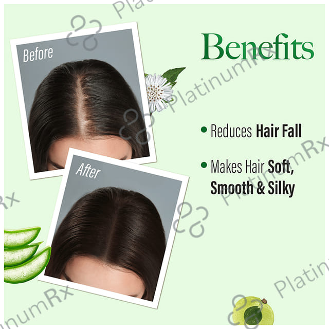 Kesh King Scalp Shampoo 1000ml