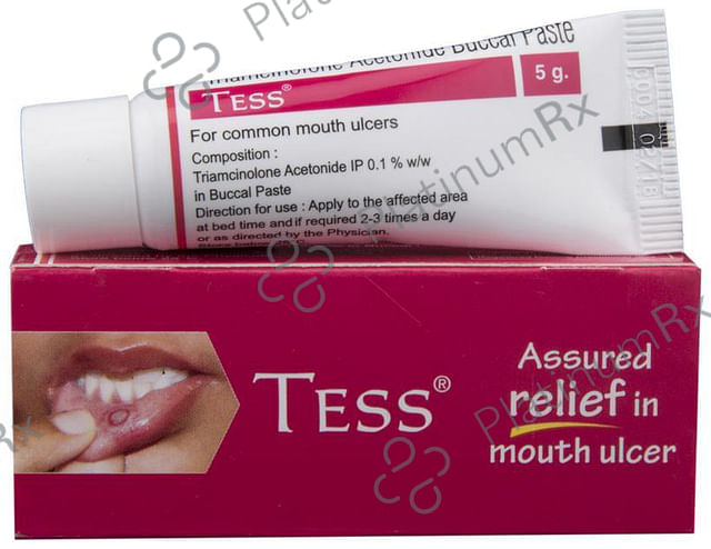 Tess 0.1% Oral Paste 5gm