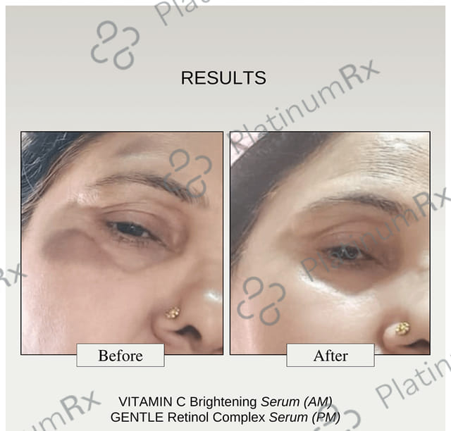 The Formularx Vitamin C Arbutin N-acetylglucosamine Serum