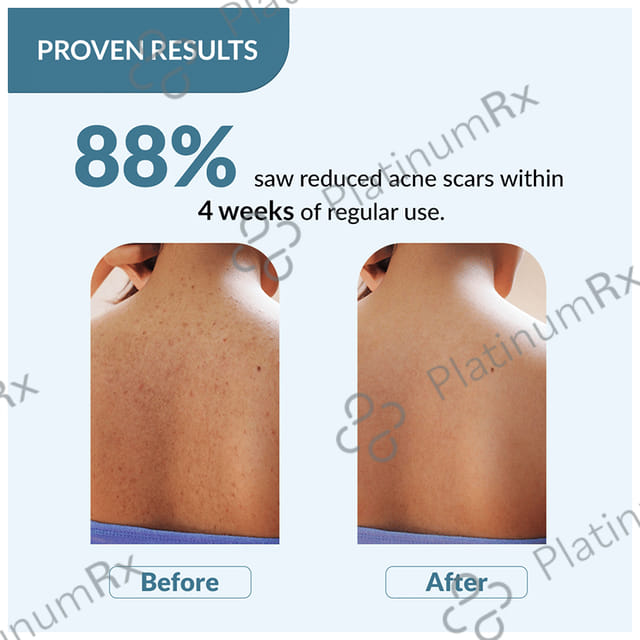 Fixderma Salizap For Body Acne Body Wash