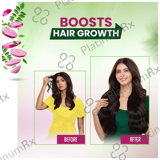 Kesh King Organic Onion Oil with Curry Leaves Reduces Hair Fall - Infused with 21 Ayurvedic Herbs 100 ml