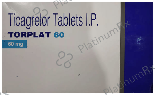Torplat 60mg Tablet 10s