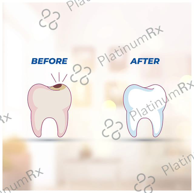 Smyle Herbal Toothpaste (100gm Each) 1 Tube