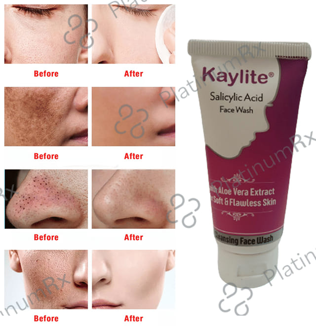 Kaylite Salicylic Acid Face Wash