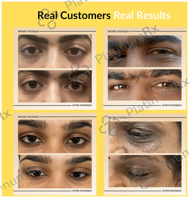 Eyecirque Under Eye Gel Serum