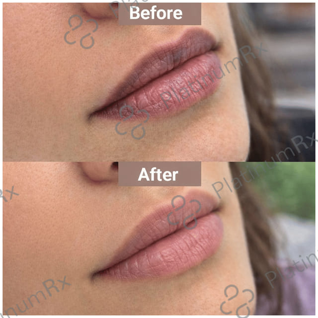 Lipz SPF 15 Lip Moisturiser 9gm
