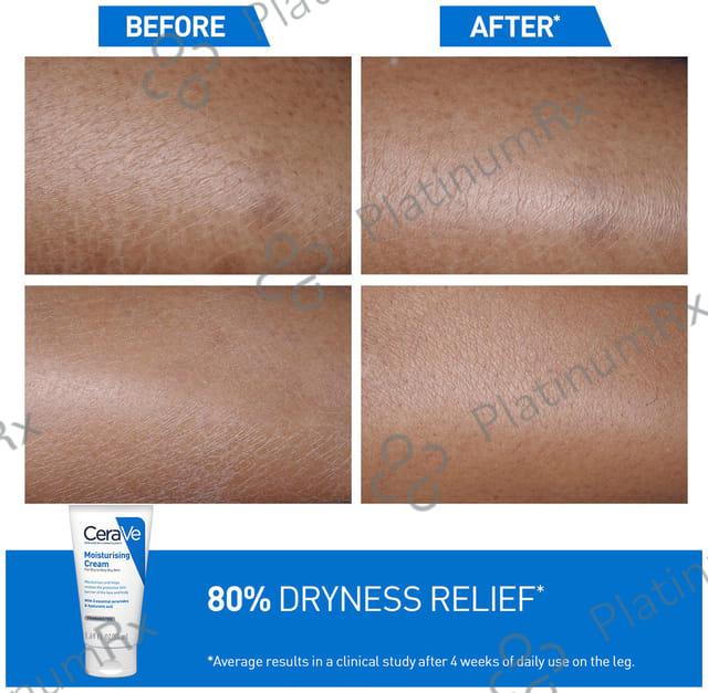 CeraVe Moisturising Cream for Dry to Very Dry Skin 177 gm