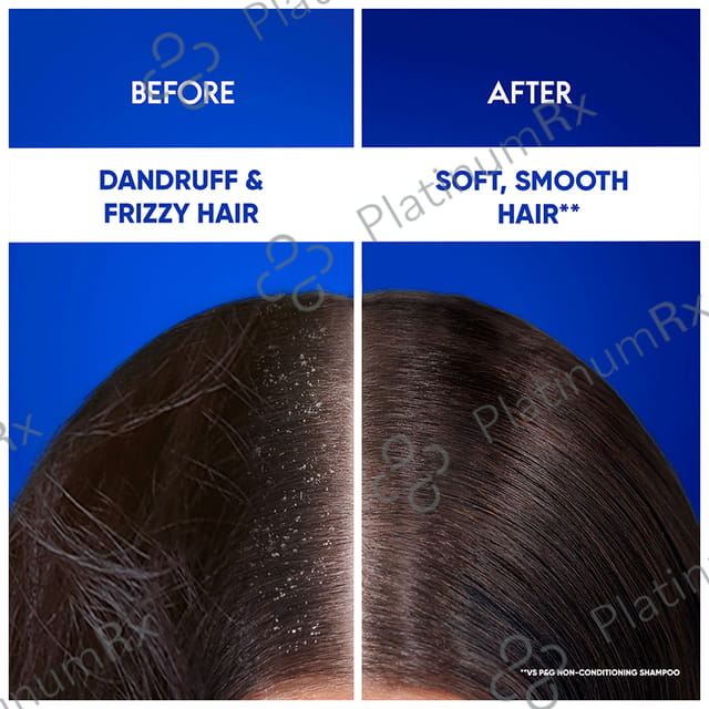 Head & Shoulders Smooth & Silky 2 in 1 Anti-Dandruff Shampoo+Conditioner 340 ml