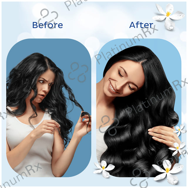 Parachute Advansed Jasmine Gold Hair Oil with 8x Vitamin E - For Strong & Shiny Hair - Non-Sticky 500 ml