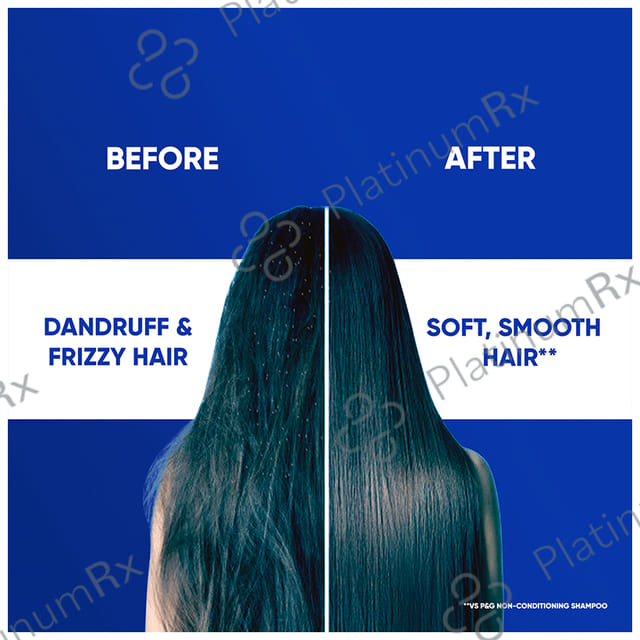 Head & Shoulders Smooth & Silky 2 in 1 Anti-Dandruff Shampoo+Conditioner 340 ml