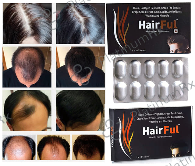 HairFul Healthy Hair Supplement Tablet (15 Each) 1 Pack