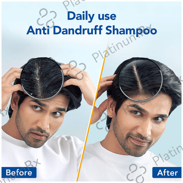 Scalpe Pro Anti Dandruff Shampoo 400ml