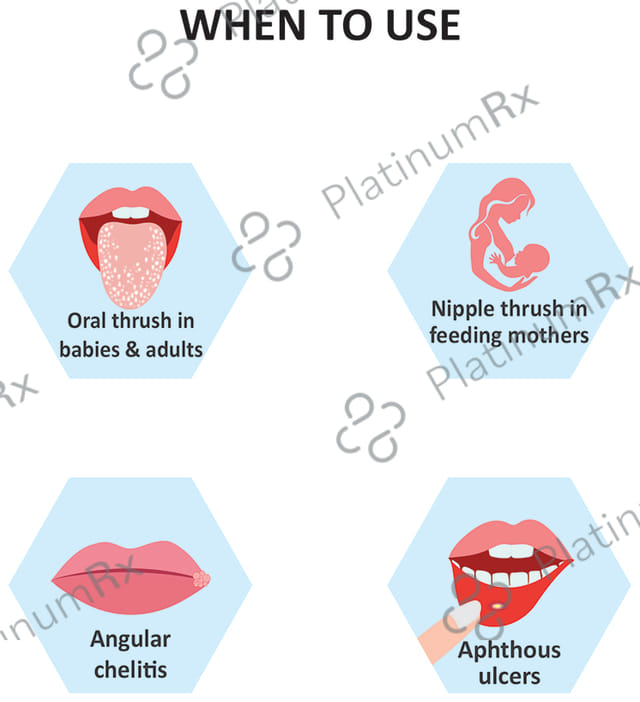 Stoma Care OT Mouth Paint 15ml