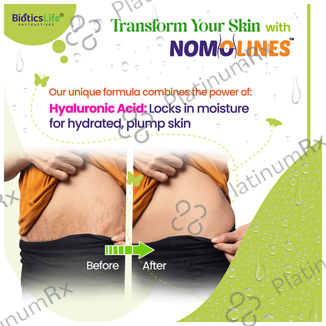 BioticsLife Nomolines for Stretch Marks Cream