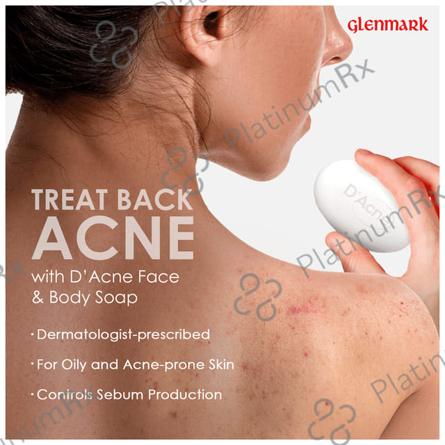 D Acne Soap 75gm
