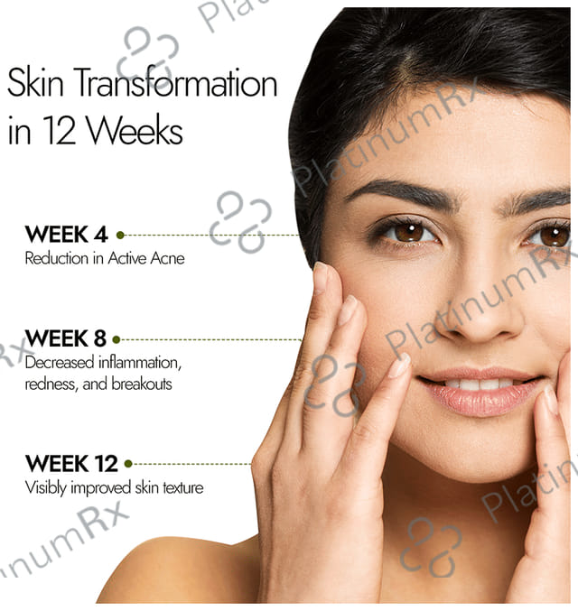 Kapiva Reduces Acne & Acne Marks Naturally - Skin Foods Acne Ease Fizz Effervescent Tablet