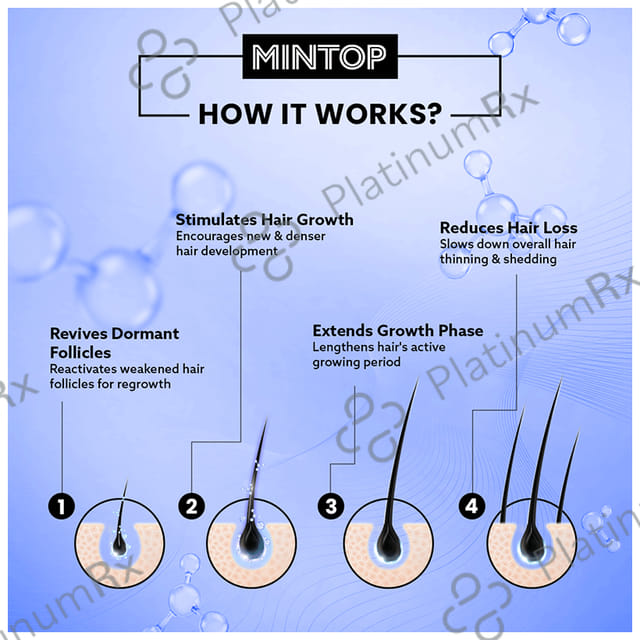 Mintop Forte 10% Hair Restore Formula Lotion 60ml