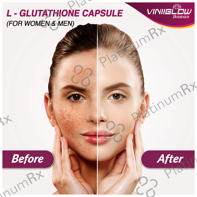 Viniiglow Botanics L-Glutathione Reduced Capsule