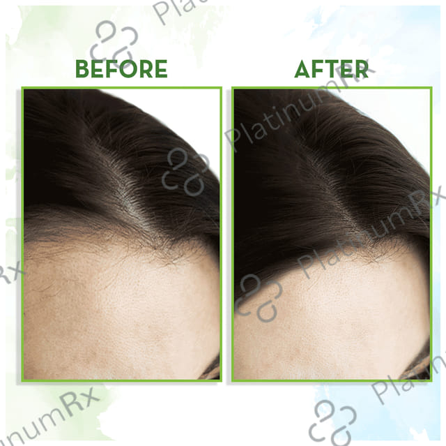 Mamaearth Rosemary Hair Growth Oil 150ml