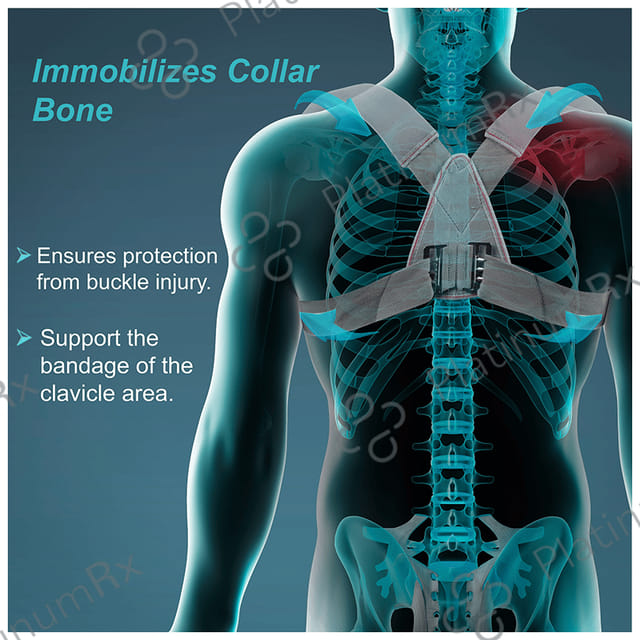 Tynor C 04 Clavicle Brace with Buckle XL 1s