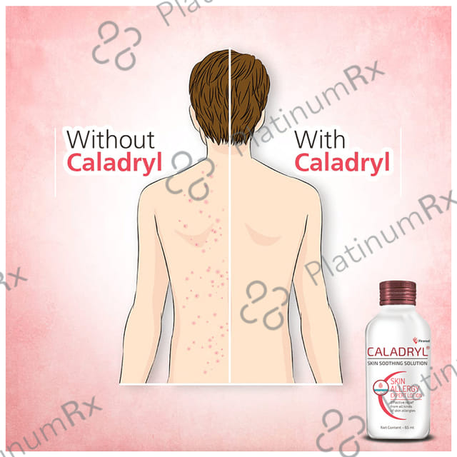 Caladryl Lotion 65ml