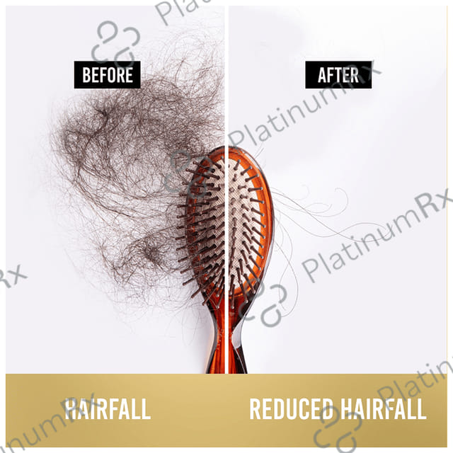 Pantene Pro-V Advanced Hairfall Solution Hairfall Control Shampoo 340 ml