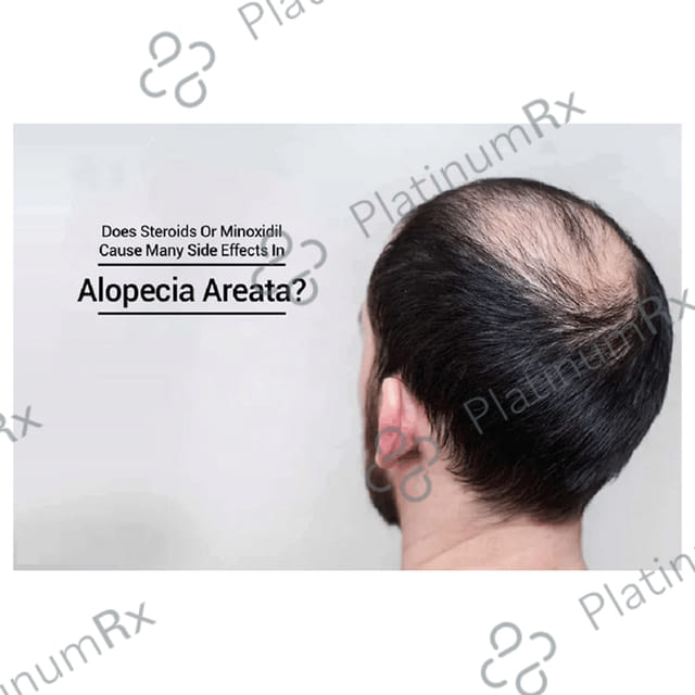 Minoqilib 5% Solution 60ml