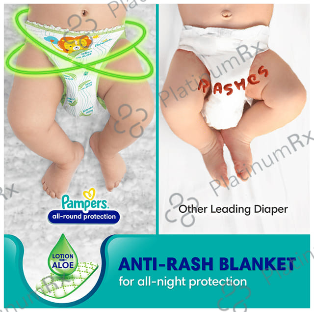Pampers All-Round Protection Anti Rash Blanket Lotion with Aloe Vera Diaper XL