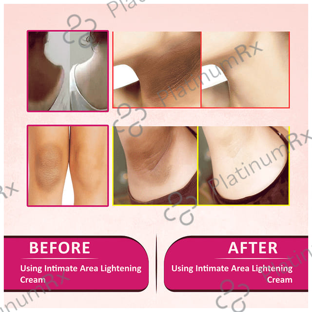 Sabates Intimate Area Lightening Cream