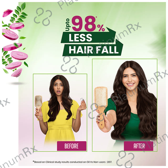 Kesh King Organic Onion Oil with Curry Leaves Reduces Hair Fall - Infused with 21 Ayurvedic Herbs 100 ml