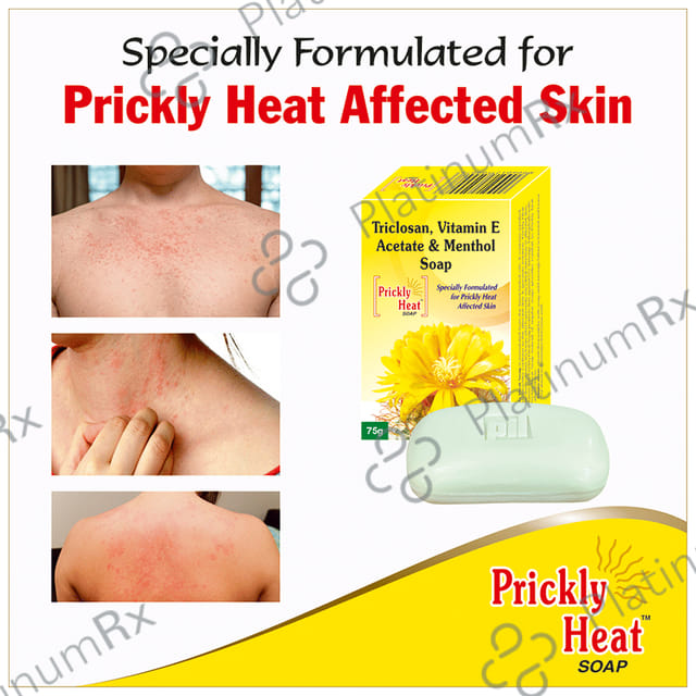 Prickly Heat Soap - Medicated Soap For Rashes & Itchiness