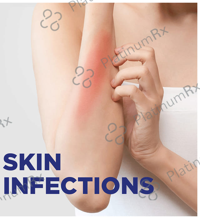 Soframycin 1% Skin Cream 30gm