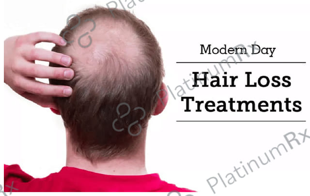 Minoqilib 5% Solution 60ml