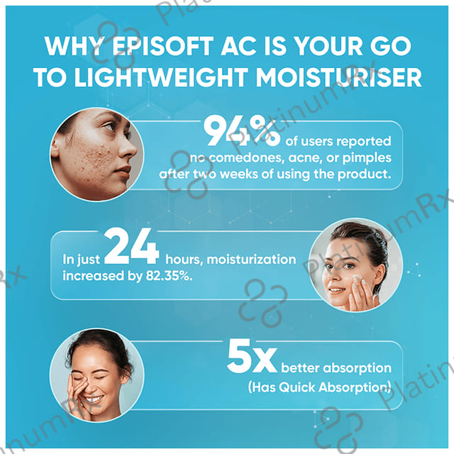Episoft AC SPF 30 Cream 75gm