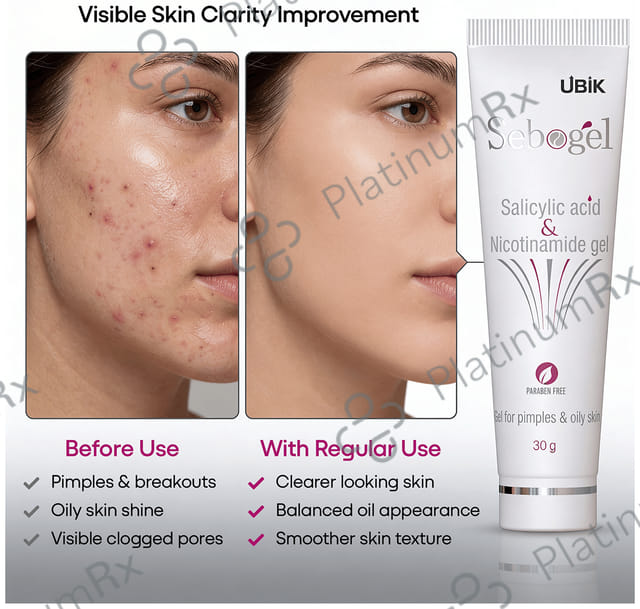 Sebogel Paraben Free 30gm