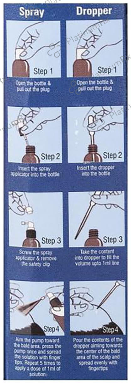 Wonhair Hair Regrowth Treatment