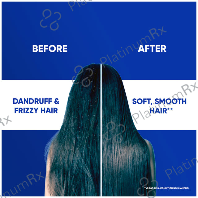 Head & Shoulders Smooth & Silky 2 in 1 Anti-Dandruff Shampoo+Conditioner 180 ml