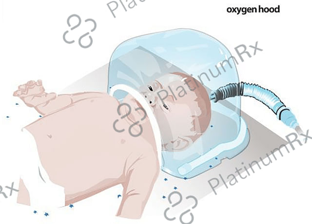 Bos Medicare Surgical Oxygen Hood for Children & New Born Baby