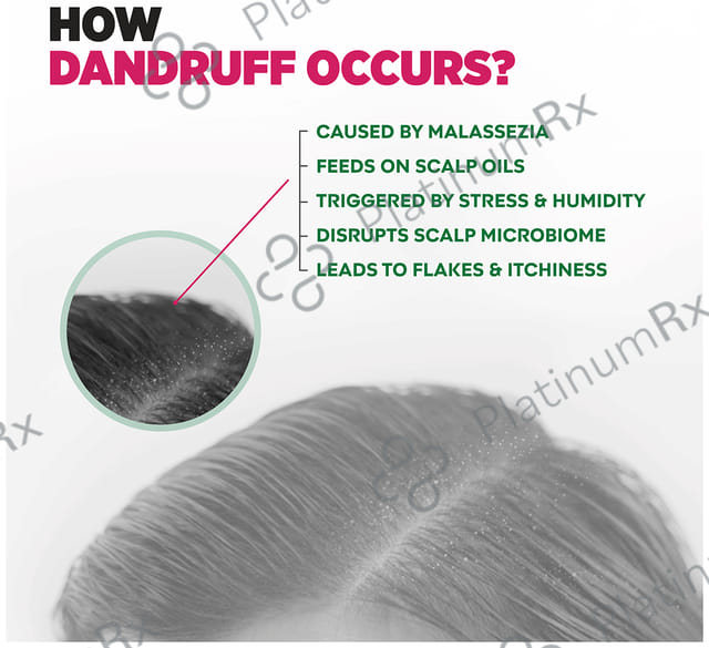 Sebamed Anti Dandruff Shampoo 200ml