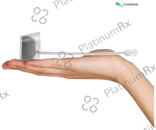 Subhag V-Conceive Home Self Insemination Cup