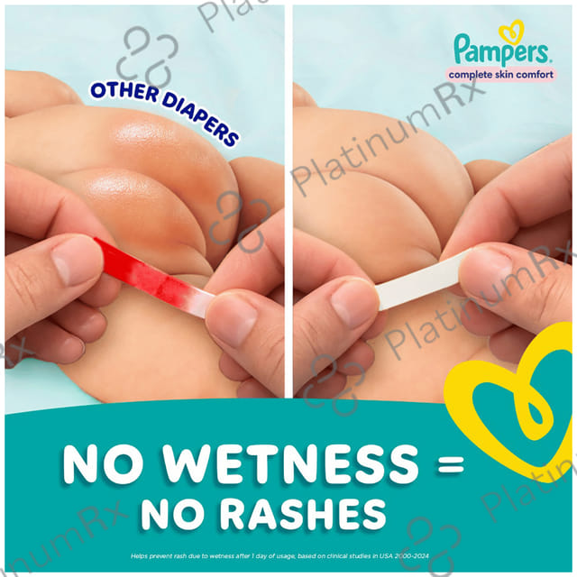 Pampers All-Round Protection Anti Rash Blanket Diaper Lotion with Aloe Vera XXL