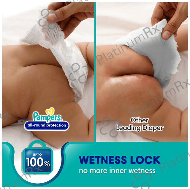 Pampers All-Round Protection Anti Rash Blanket Lotion with Aloe Vera Diaper XL