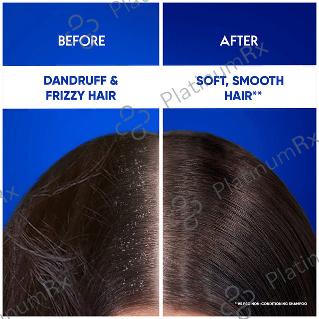 Head & Shoulders Cool Menthol 2 in 1 Anti-Dandruff Shampoo+Conditioner