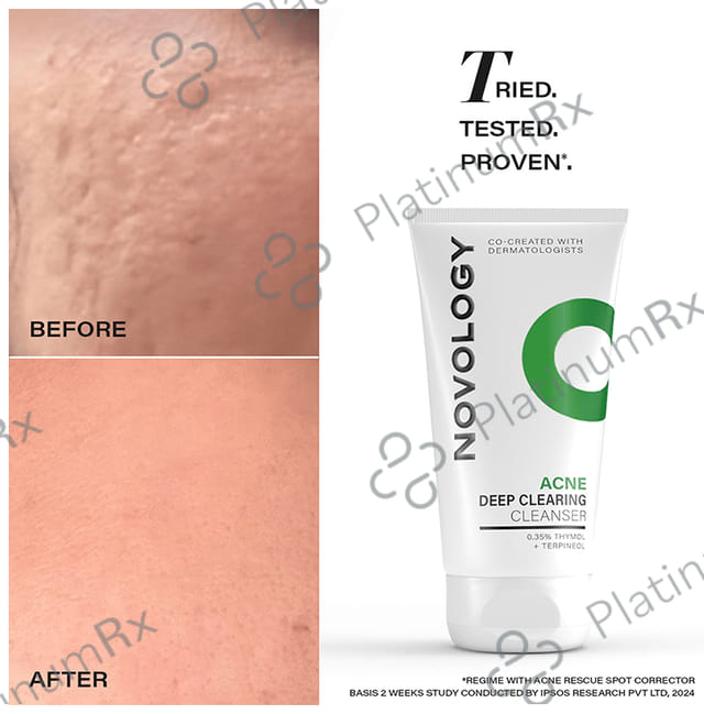 Novology 0.35% Thymol + Terpineol Acne Reduction Cleanser 150ml