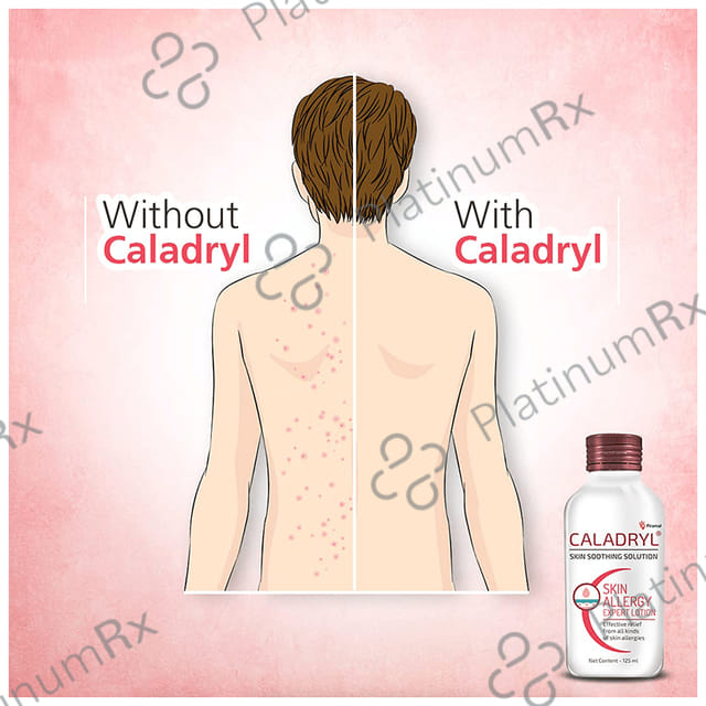 Caladryl Lotion 125ml